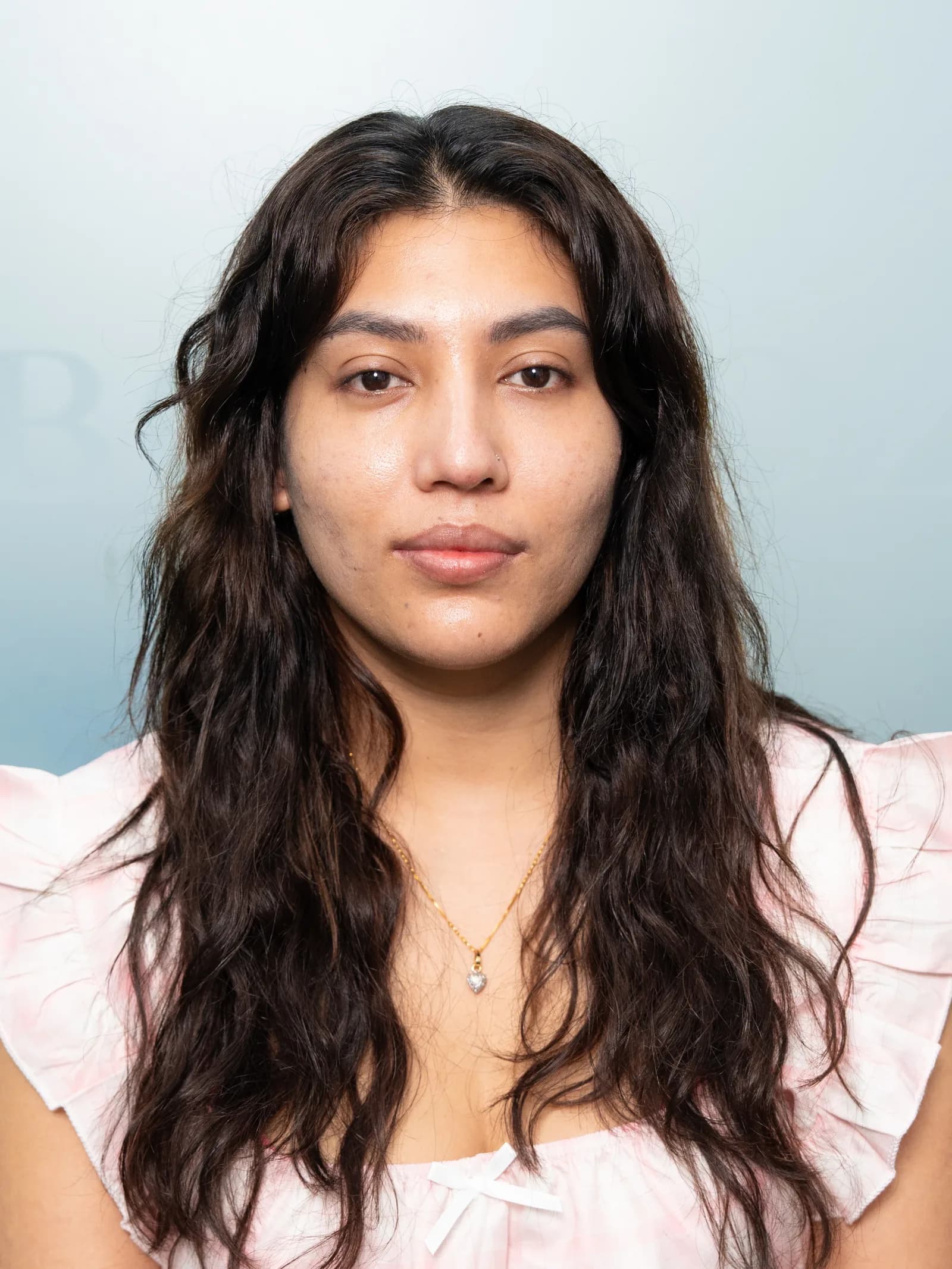 Revision rhinoplasty — at the follow-up visit