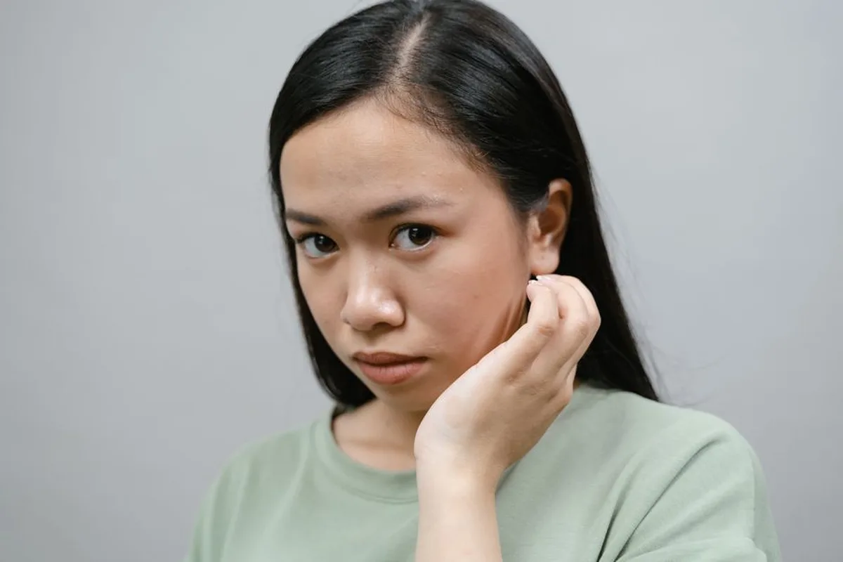 Sẹo rỗ và lỗ chân lông to khác nhau thế nào? Có điều trị cùng lúc được không?
