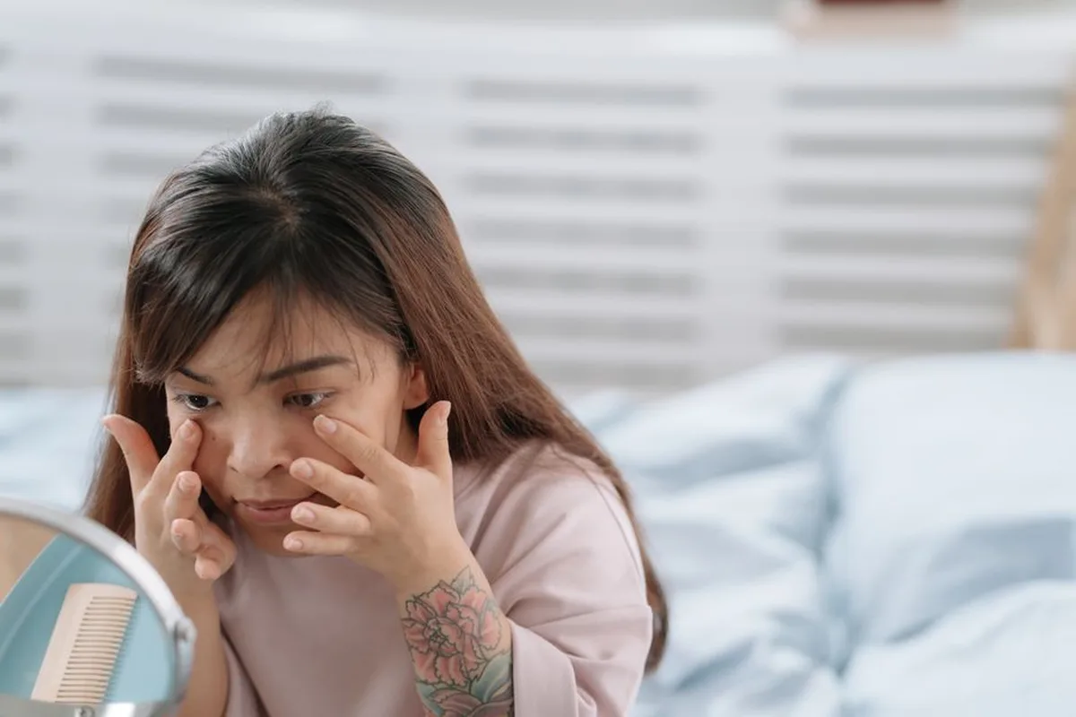 Trị sẹo rỗ ở độ tuổi nào phù hợp? Có giới hạn tuổi không?