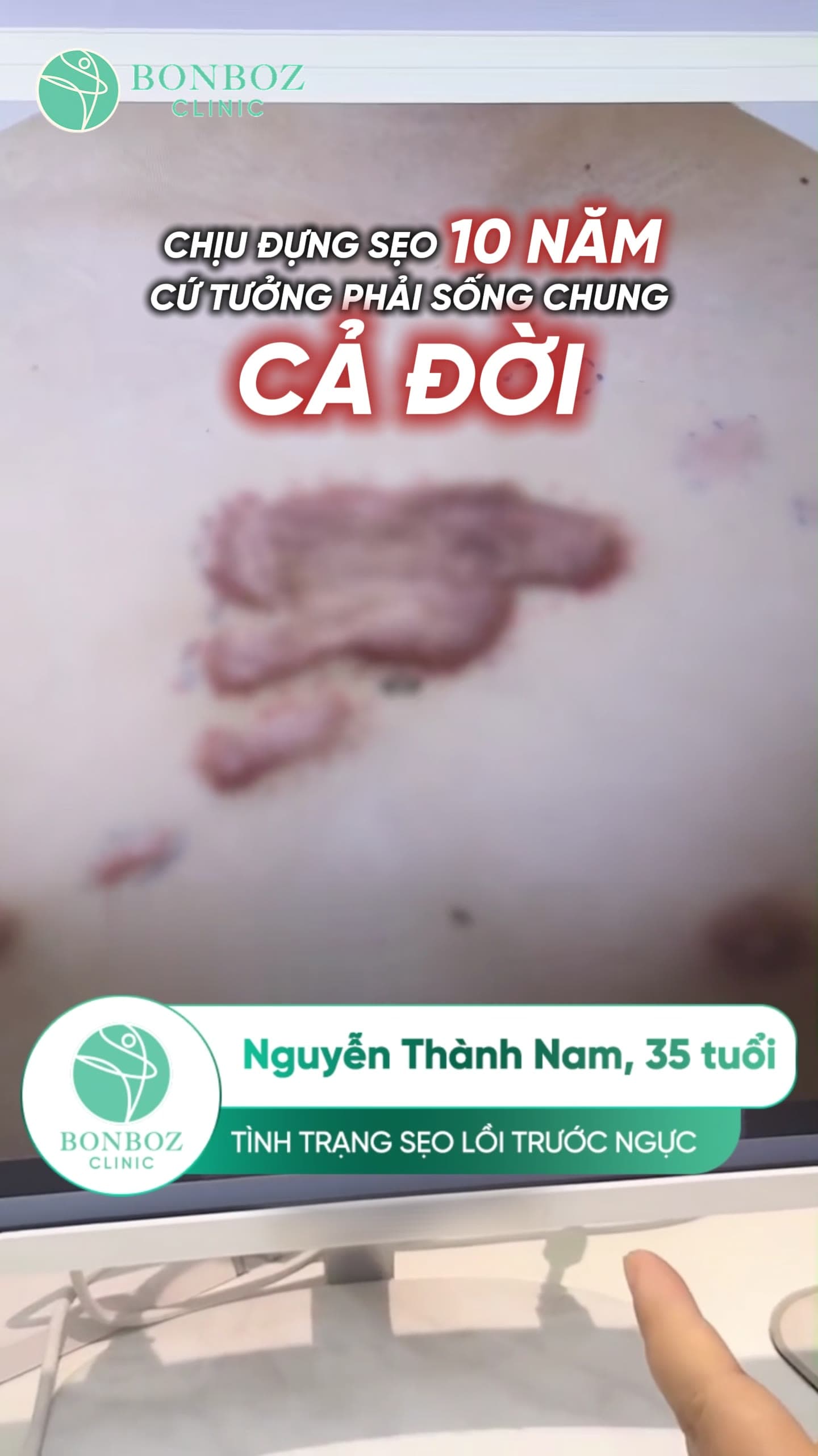 Video điều trị 01