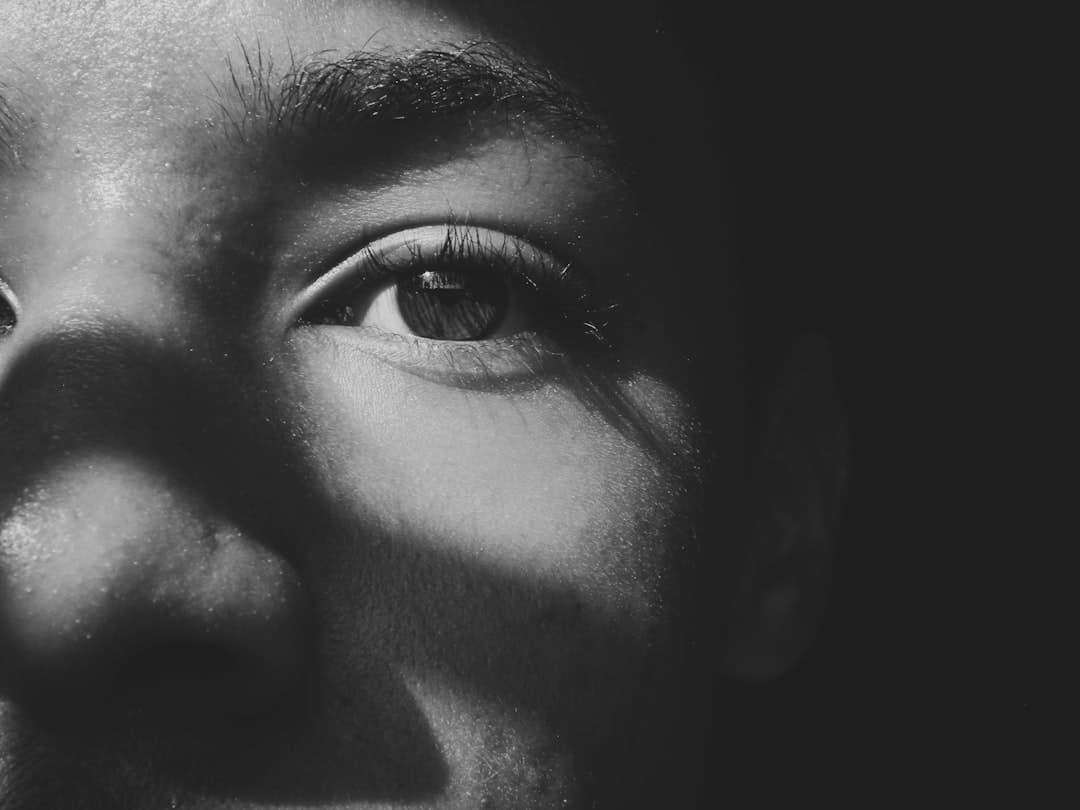 Can I Wear Eye Makeup After Double Eyelid Surgery? When Is It Safe?