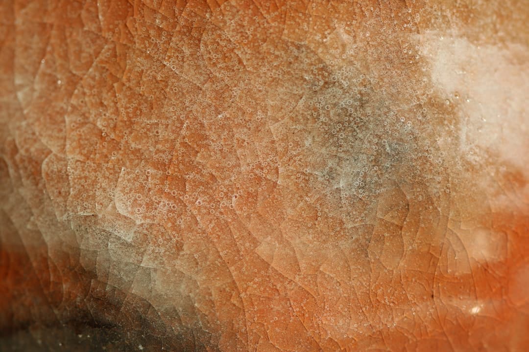 Acné por uso prolongado de corticoides: Signos de identificación y cómo tratarlo