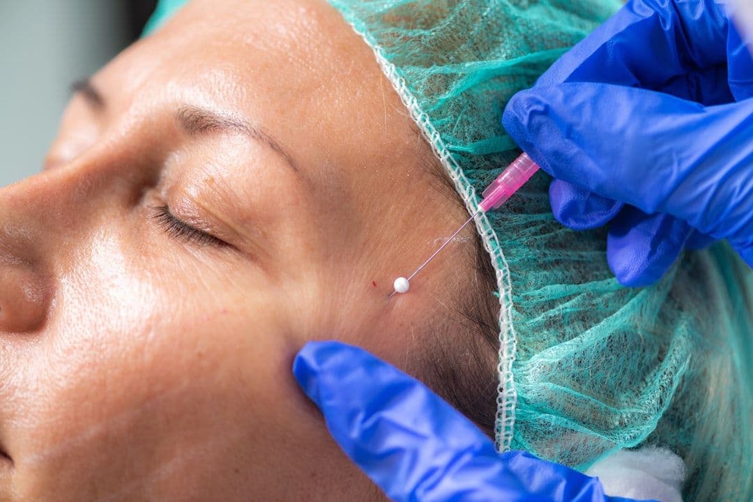 肉毒素 (Botox) 与填充剂 (Filler):何时该用哪一种?BonBoz 医生专业解析