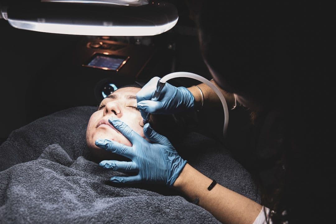 Ảnh minh hoạ — Microdermabrasion 2
